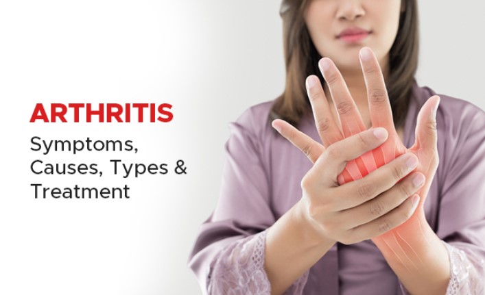 Understanding Arthritis: Symptoms, Causes, and Treatments